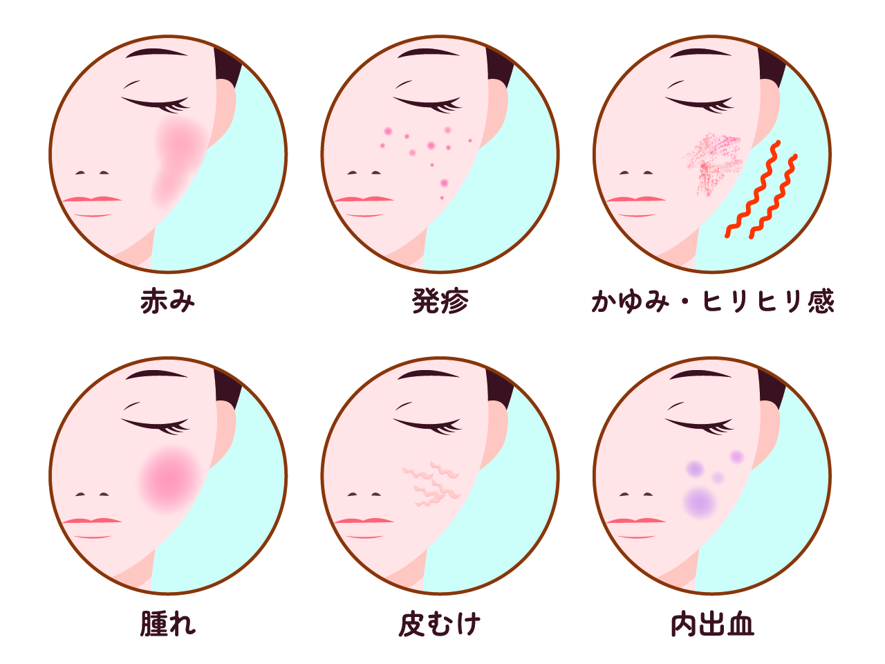 ダーマペン_ダウンタイム