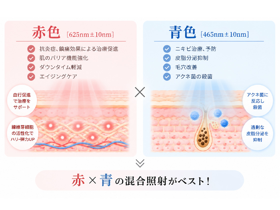 KOライトの赤色（625nm）と青色（465nm）の効果を示す図。赤色は炎症・傷跡・肌のバリア機能・ダウンタイム軽減・エイジングケア、青色はニキビ治療・皮脂分泌抑制・毛穴改善・アクネ菌の殺菌。赤×青の混合照射がベスト