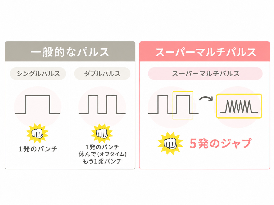 一般的なパルス（シングルパルス・ダブルパルス）とスーパーマルチパルスの違いを示す図。1発のパンチではなく5発のジャブのように細かく照射