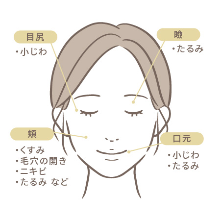 KOライトの施術部位。目尻（小じわ）・瞼（たるみ）・頬（くすみ・毛穴の開き・ニキビ・たるみ）・口元（小じわ・たるみ）を示す顔のイラスト